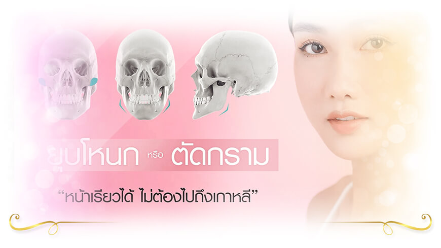 Masterpiece Hospital ตัดกราม ให้เข้ากับรูปหน้าคุณ